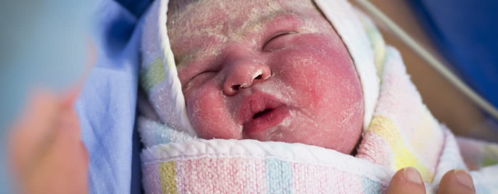 ¿Qué sabe sobre la cera blanca en el cuerpo del bebé?