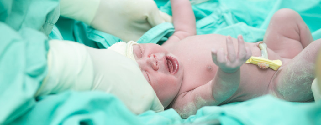 المخاطر عند الأطفال حديثي الولادة من متلازمة استنشاق السائل الأمنيوسي العقي