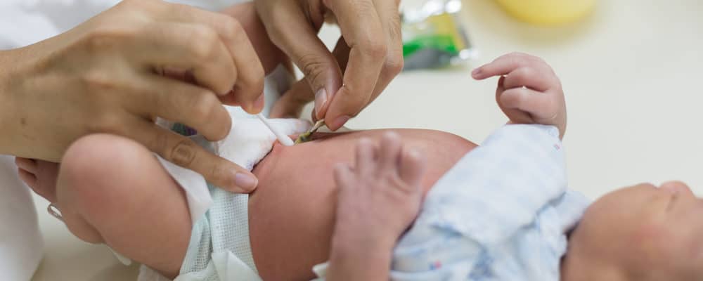 4種簡單的方法來幫助您護理新生兒臍帶
