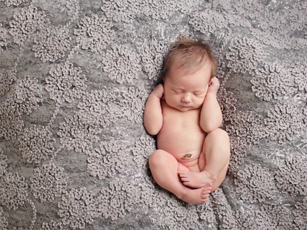 Lombelico del neonato ha un cattivo odore, cosa dovrebbe fare la madre?