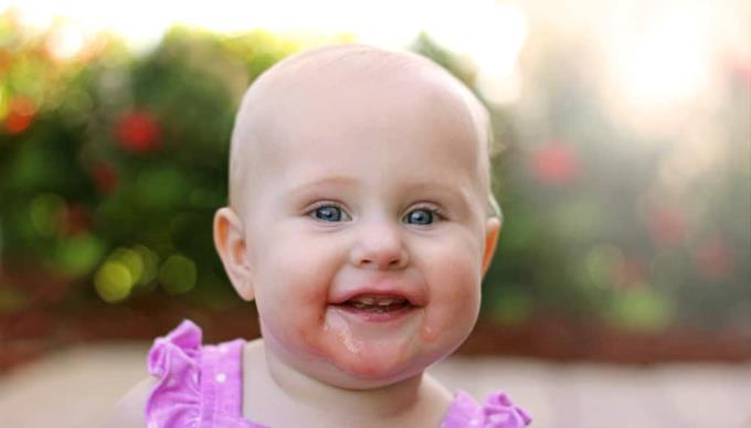 Skin diseases in babies: Mother knows early to treat the baby!