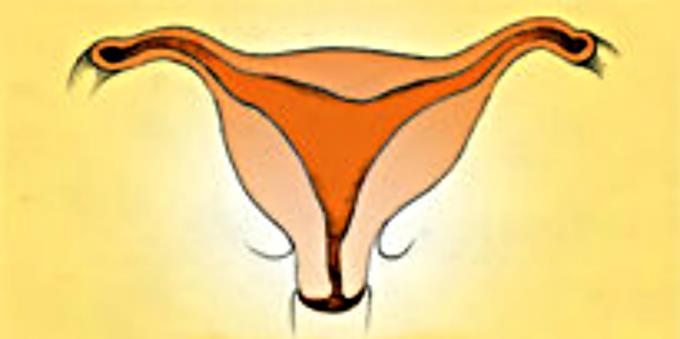 子宮異常會影響生育