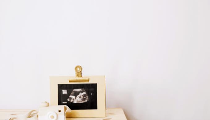 4D těhotenský ultrazvuk a co by těhotné ženy měly vědět