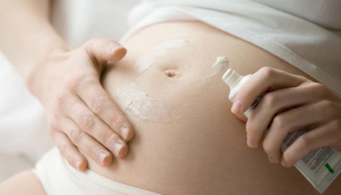 임신 중 튼살 : 예방 및 치료 방법
