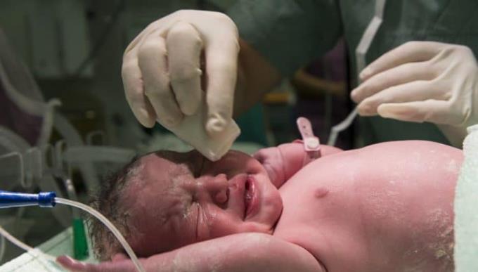 Know if your baby is normal after birth