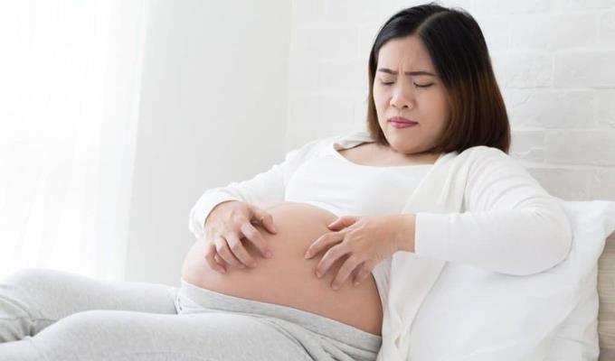 妊娠中の胃のかゆみ：かゆみを解消するための原因と6つのヒント